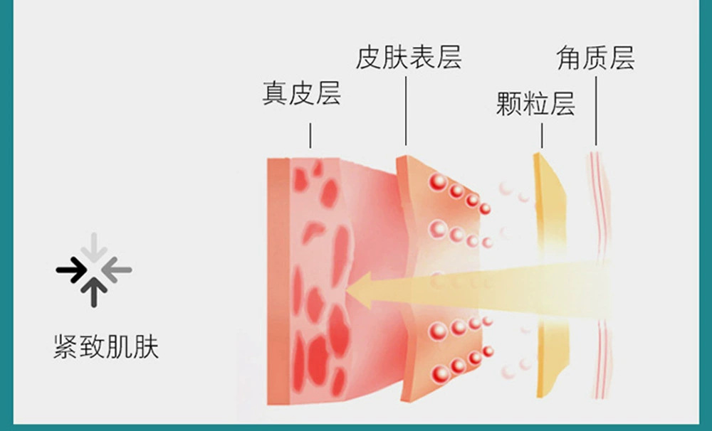 射频美容仪 - 锦品出海 射频美容仪