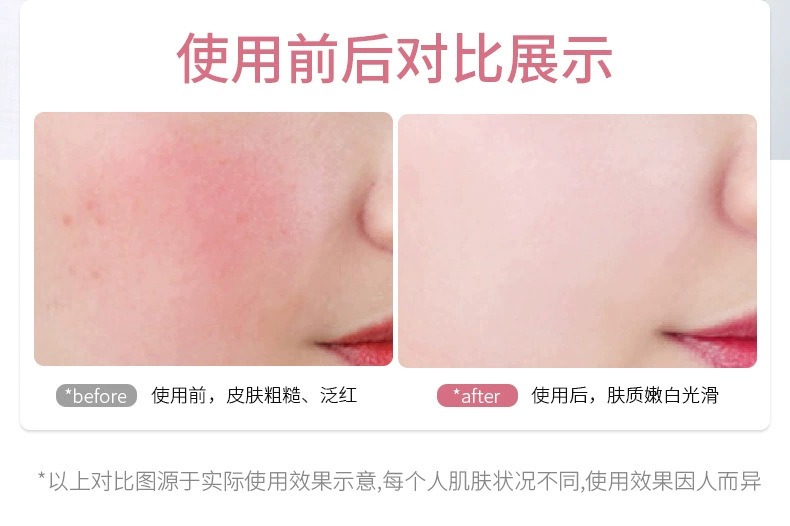 家用射频美容仪 - 锦品出海 家用射频美容仪