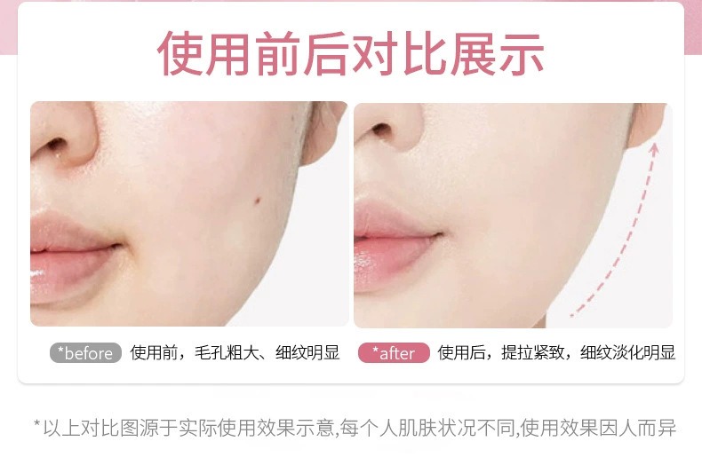 家用射频美容仪 - 锦品出海 家用射频美容仪